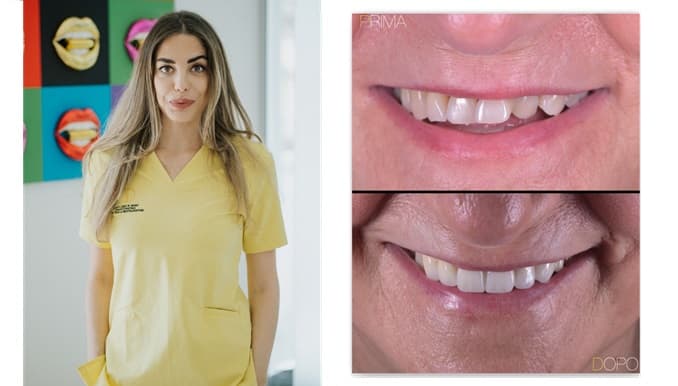 Estetica e parodontite: tornare a sorridere senza perdere i propri denti