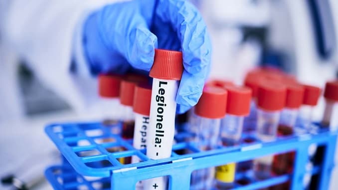 Legionella al Fazzi, agenti in corsia: si indaga sull'acqua