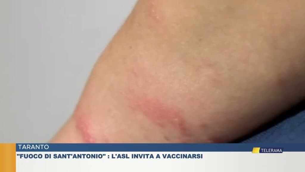 Taranto. "Fuoco di Sant'Antonio": l'Asl invita a vaccinarsi
